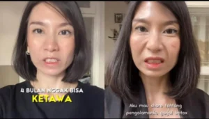 Wajah Kencang Karena Botox, Ratu Felisha Tersiksa Tak Bisa Tertawa Saat Syuting Film