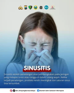 Pilek Tak Sembuh Lebih dari 10 Hari? Waspada Gejala Gangguan Sinus